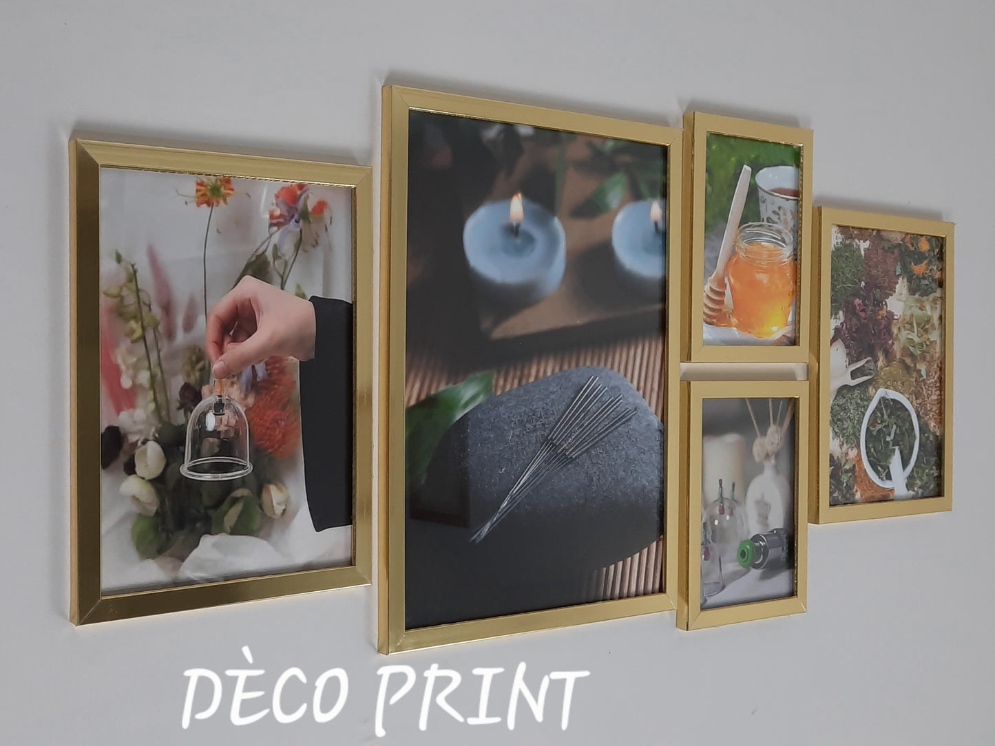 لوحات جدارية خاصة بعيادات الحجامة