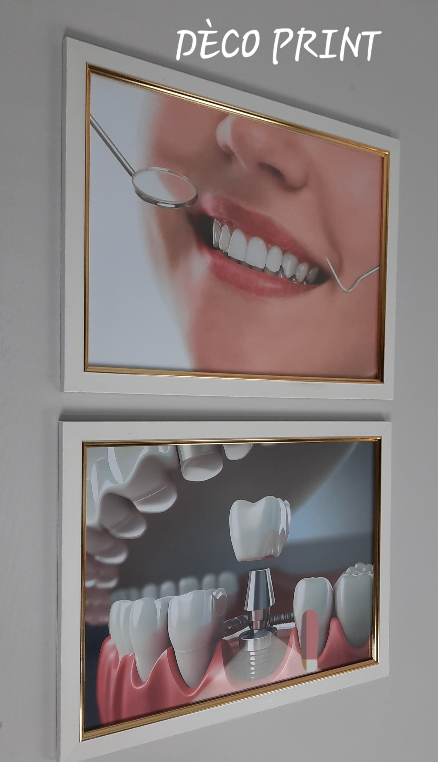 لوحات جدارية خاصة بعيادات طب الاسنان