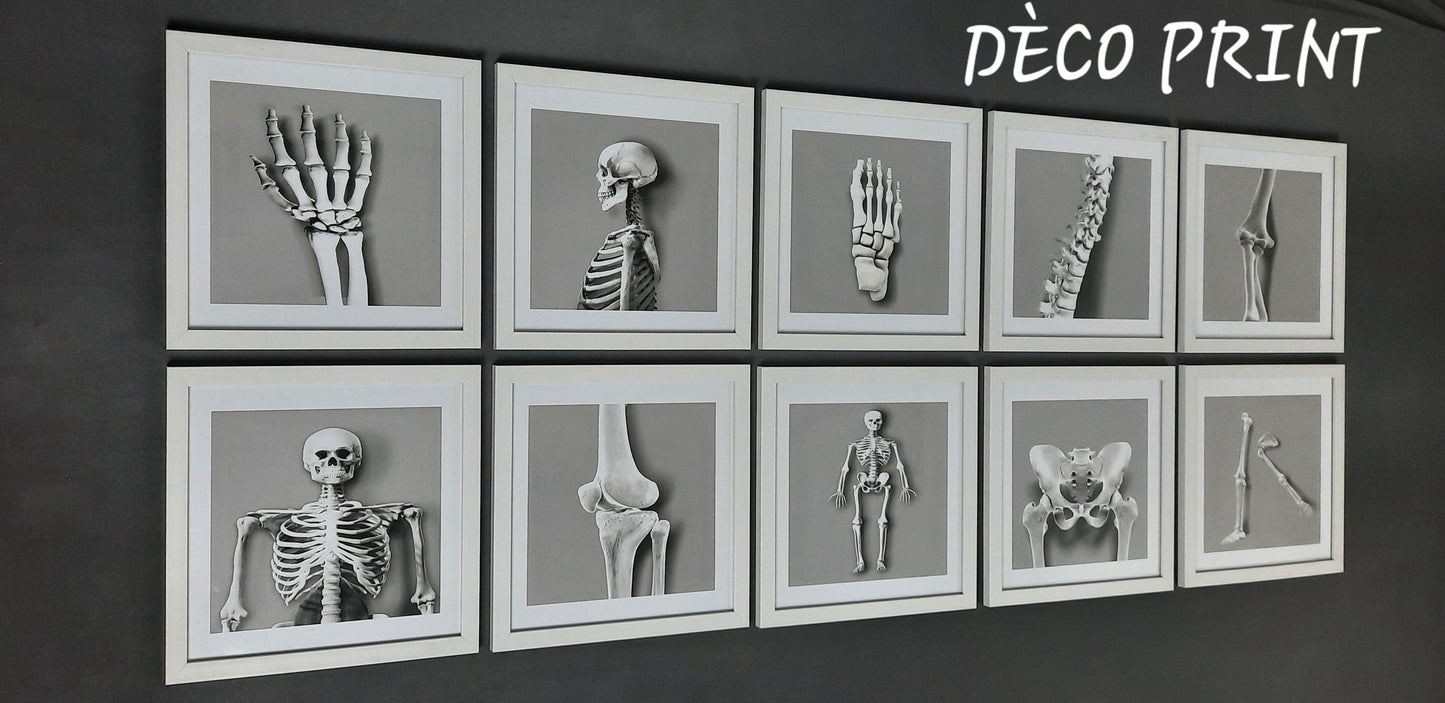 لوحات جدارية خاصة بعيادات طب العضام