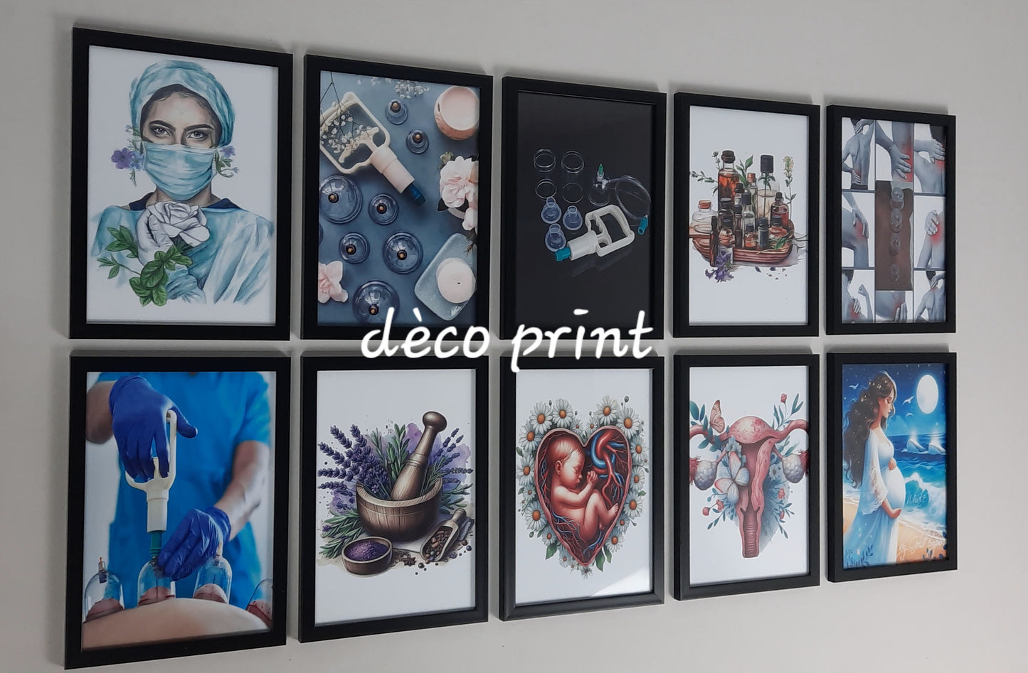 لوحات جدارية خاصة بعيادات الحجامة