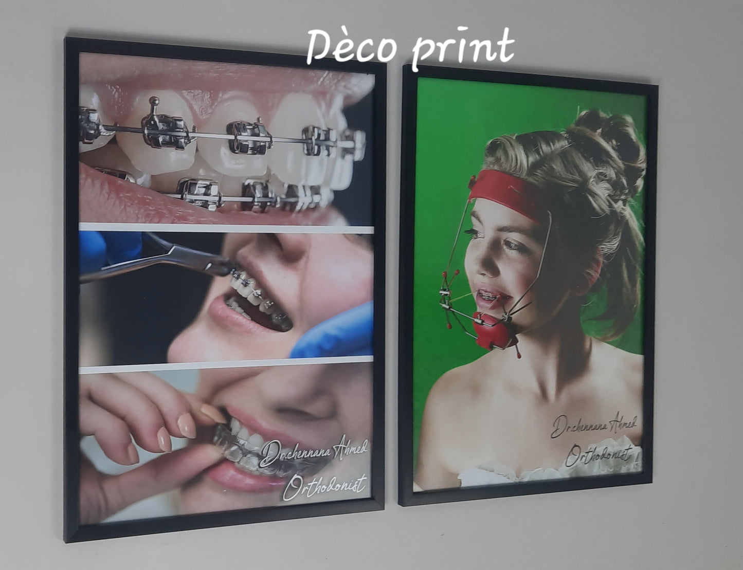 لوحات جدارية خاصة بعيادات طب الاسنان