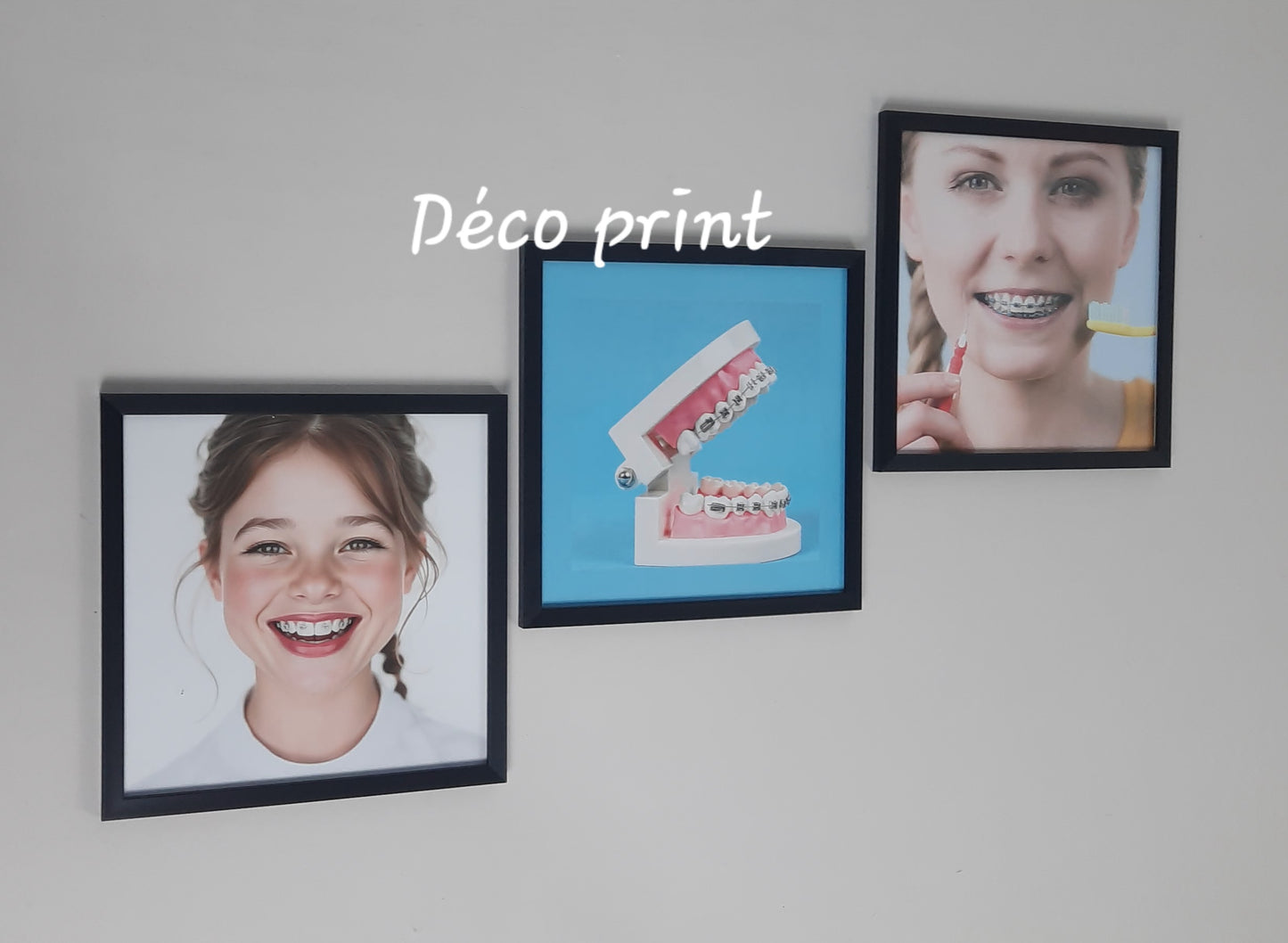 لوحات جدارية خاصة بعيادات طب الاسنان