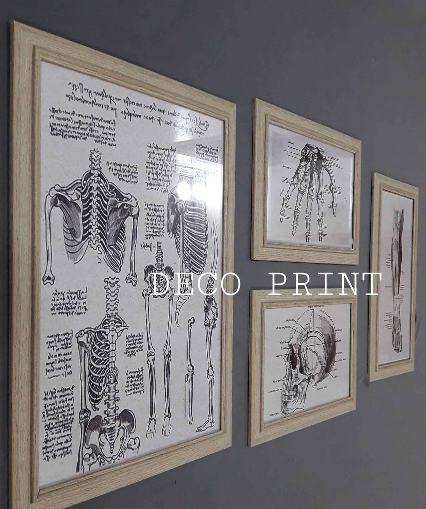 لوحات جدارية خاصة بعيادات طب العضام