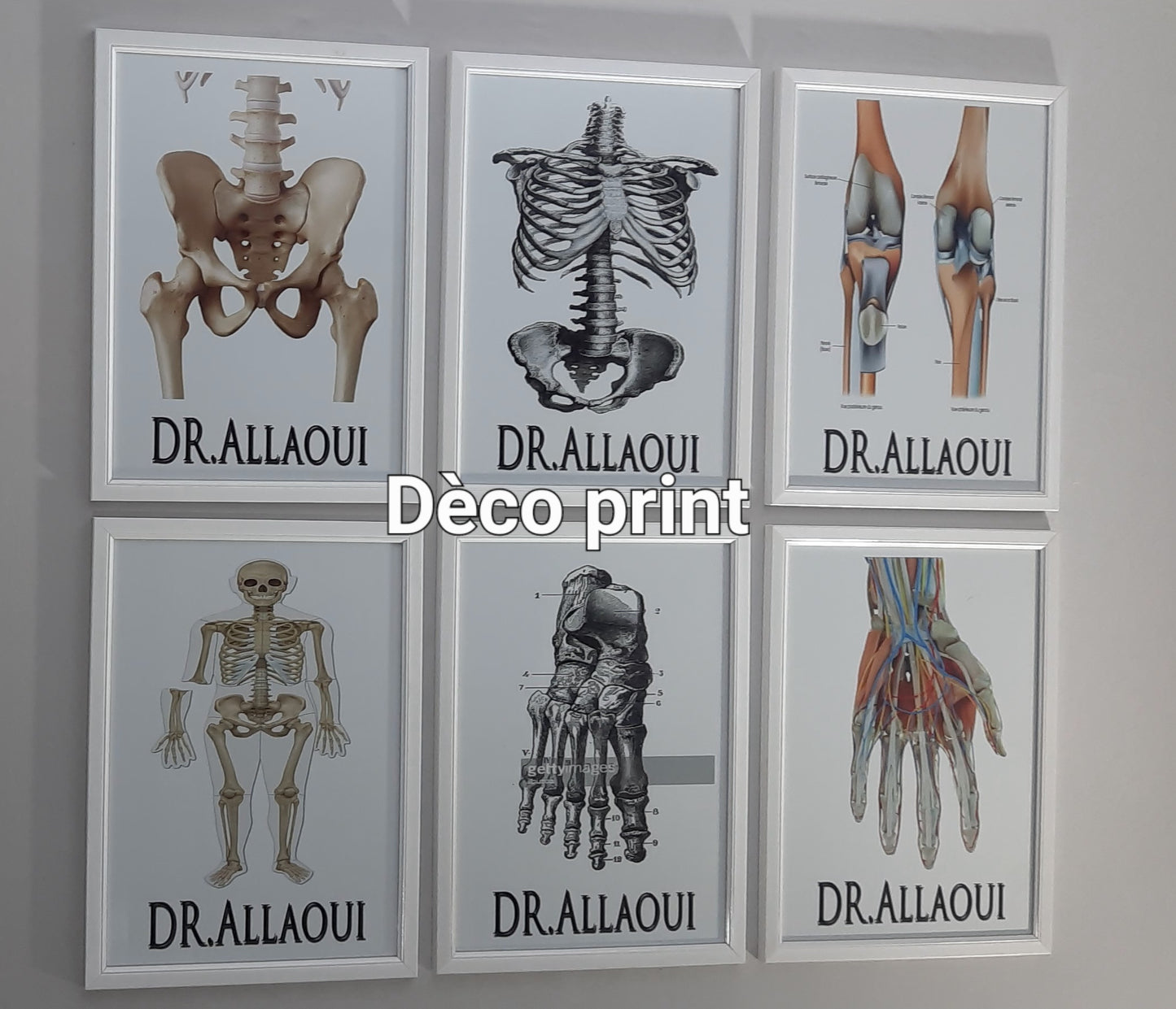 لوحات جدارية خاصة بعيادات طب العضام