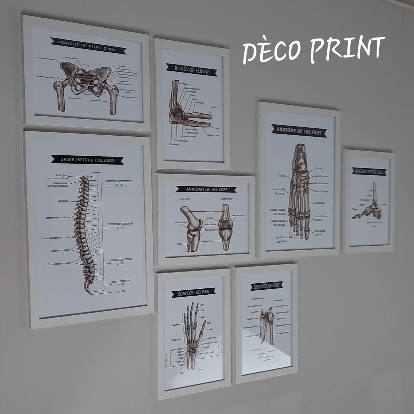 لوحات جدارية خاصة بعيادات طب العضام