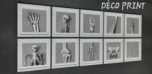 لوحات جدارية خاصة بعيادات طب العضام