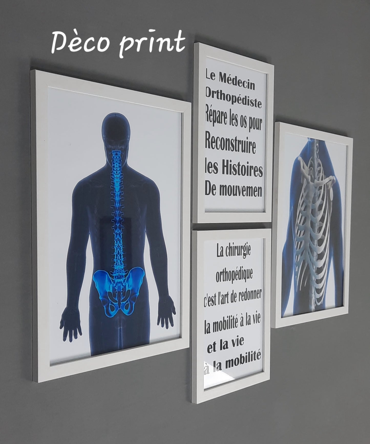 لوحات جدارية خاصة بعيادات طب العضام