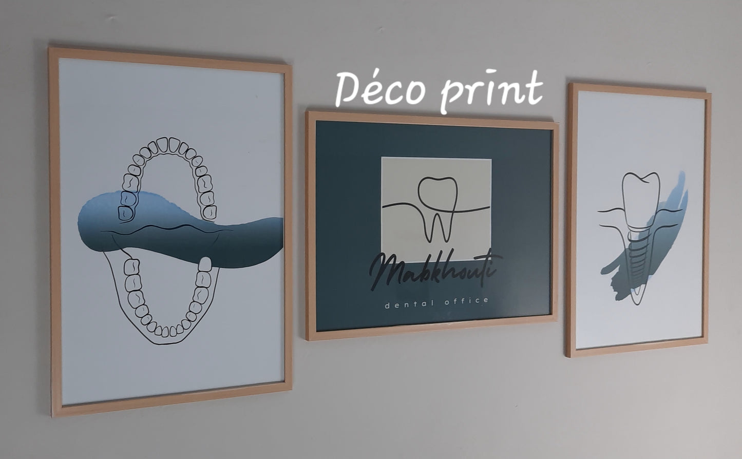 لوحات جدارية خاصة بعيادات طب الاسنان