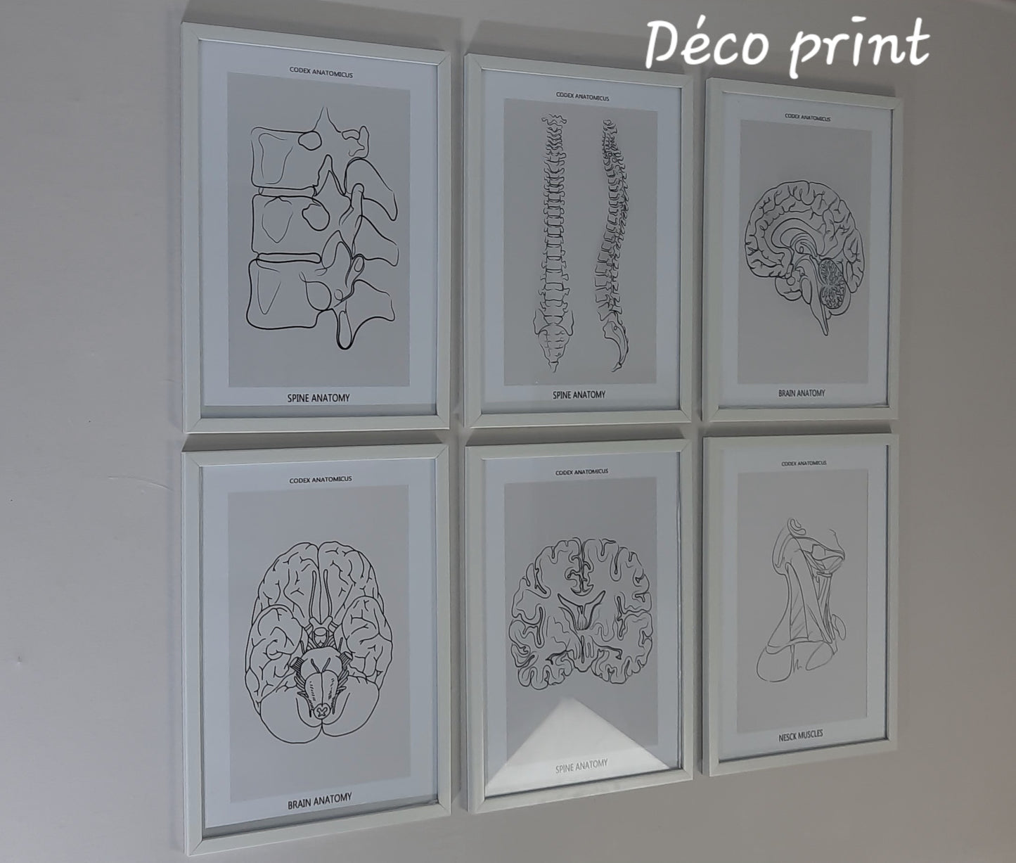 لوحات جدارية خاصة بعيادات طب العضام