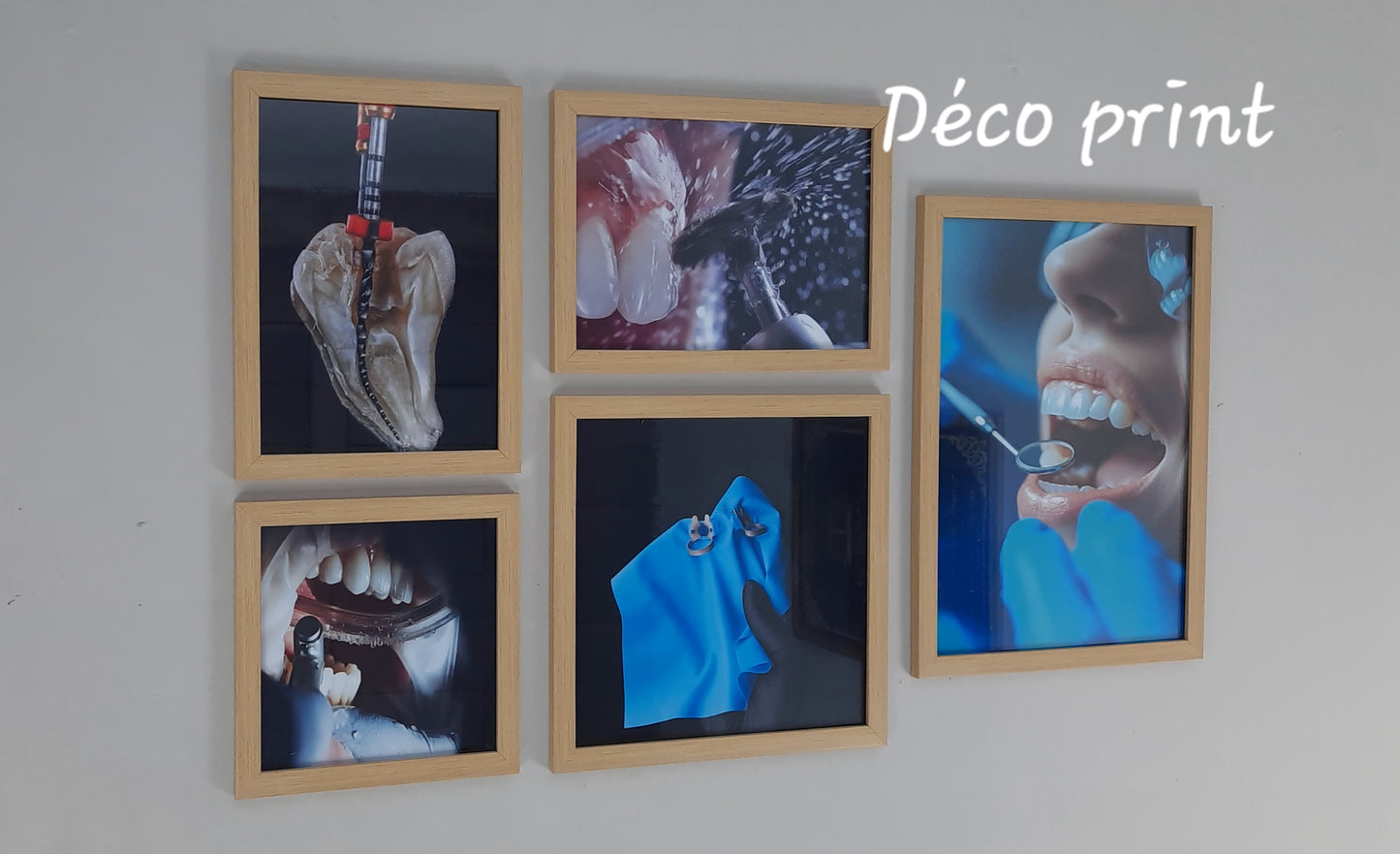 لوحات جدارية خاصة بعيادات طب الاسنان